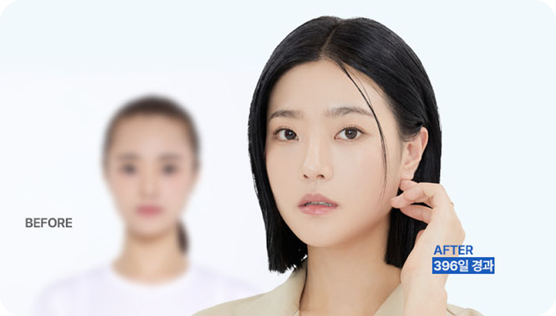 Remove excess space on the face