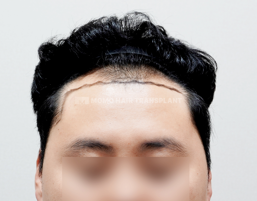 Before