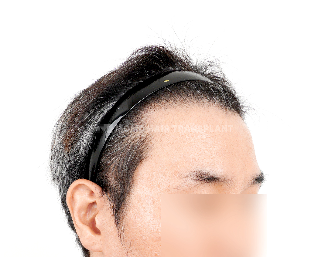 After