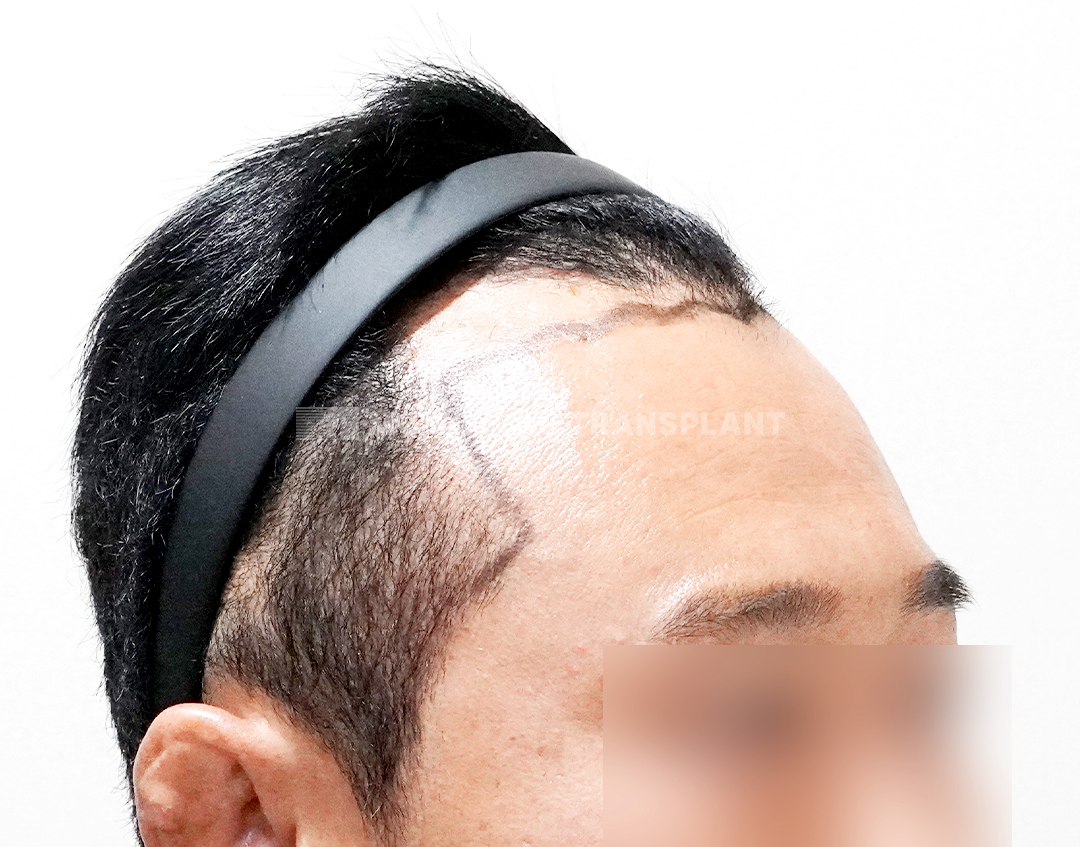 Before