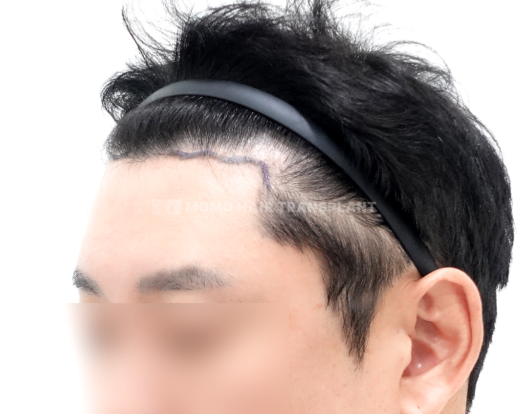 Before