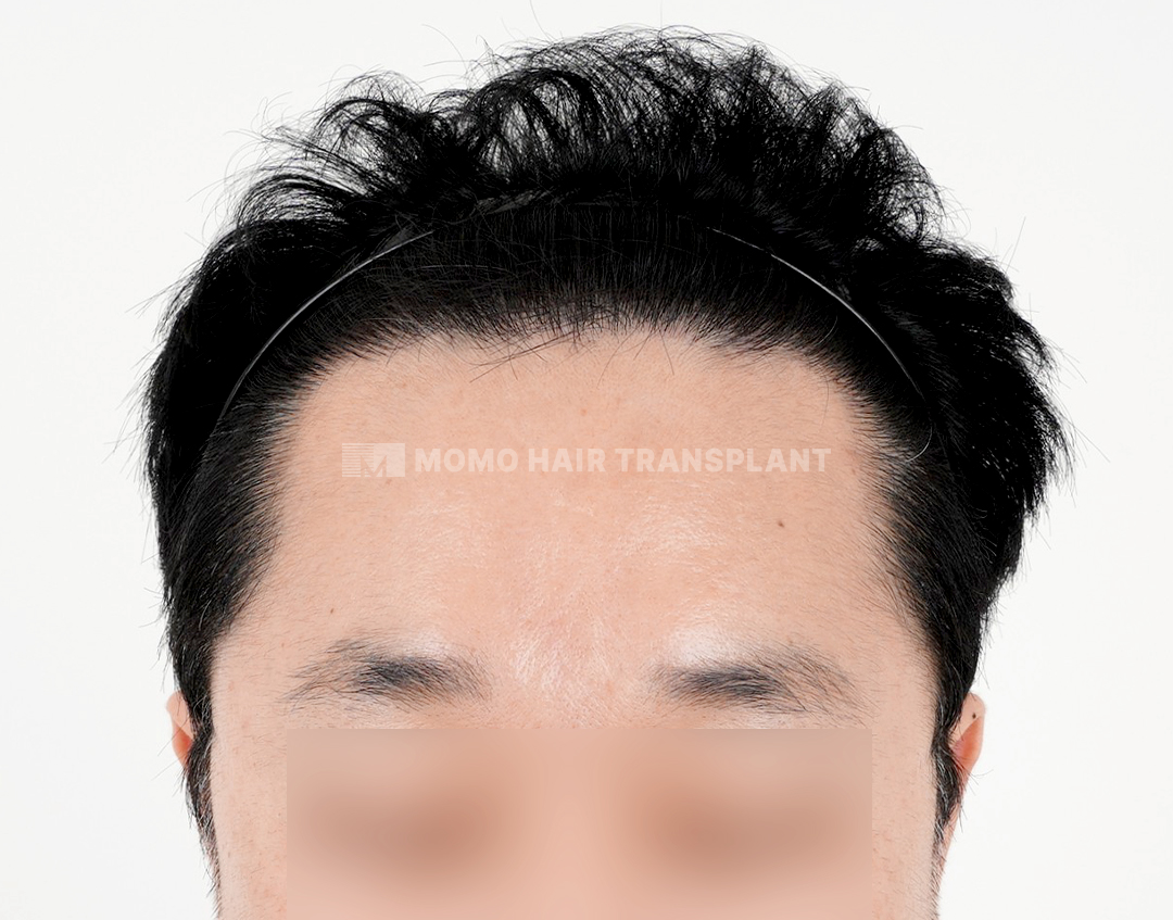 After