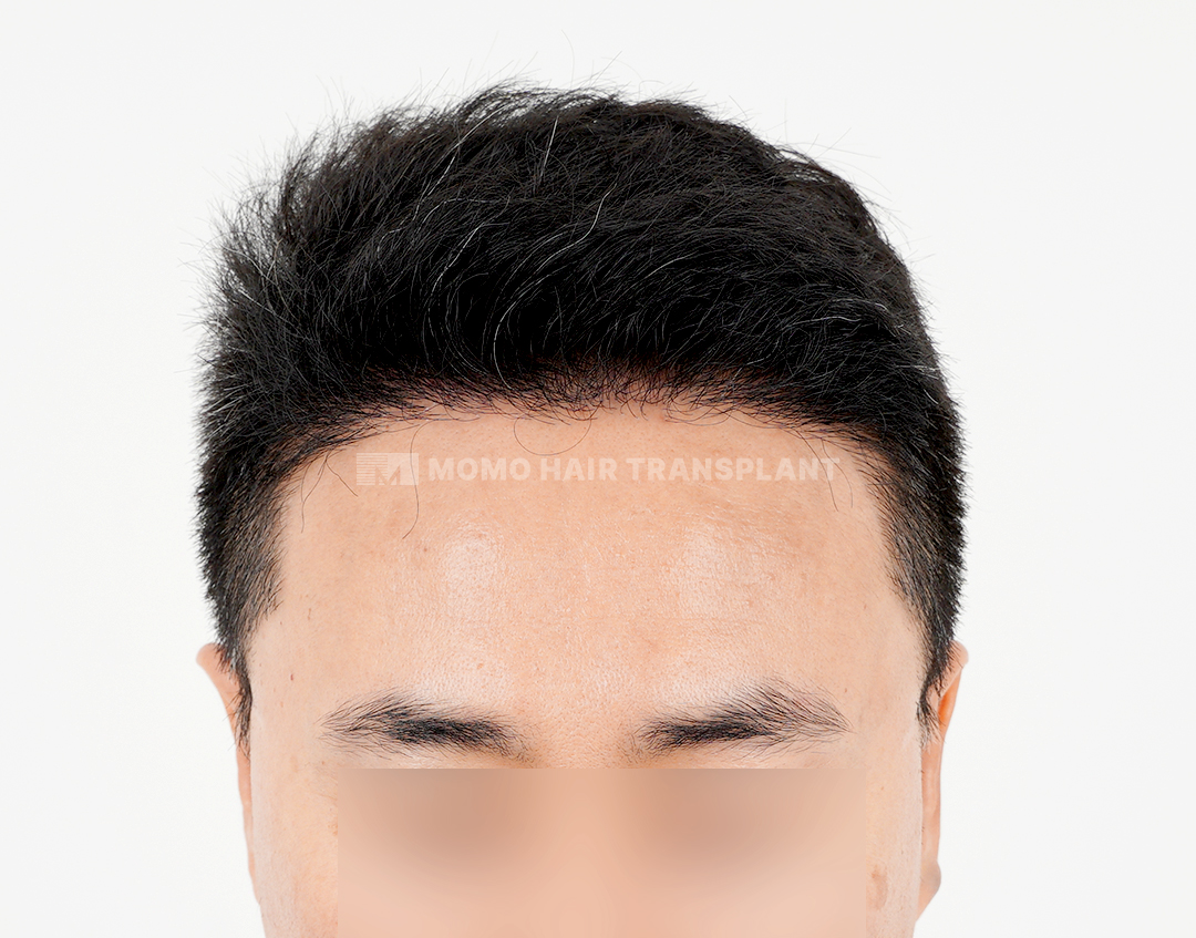 After
