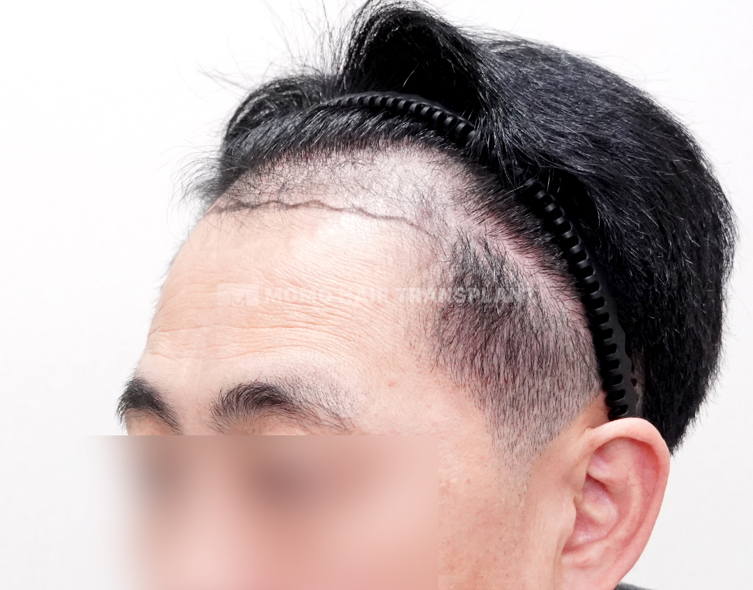 Before