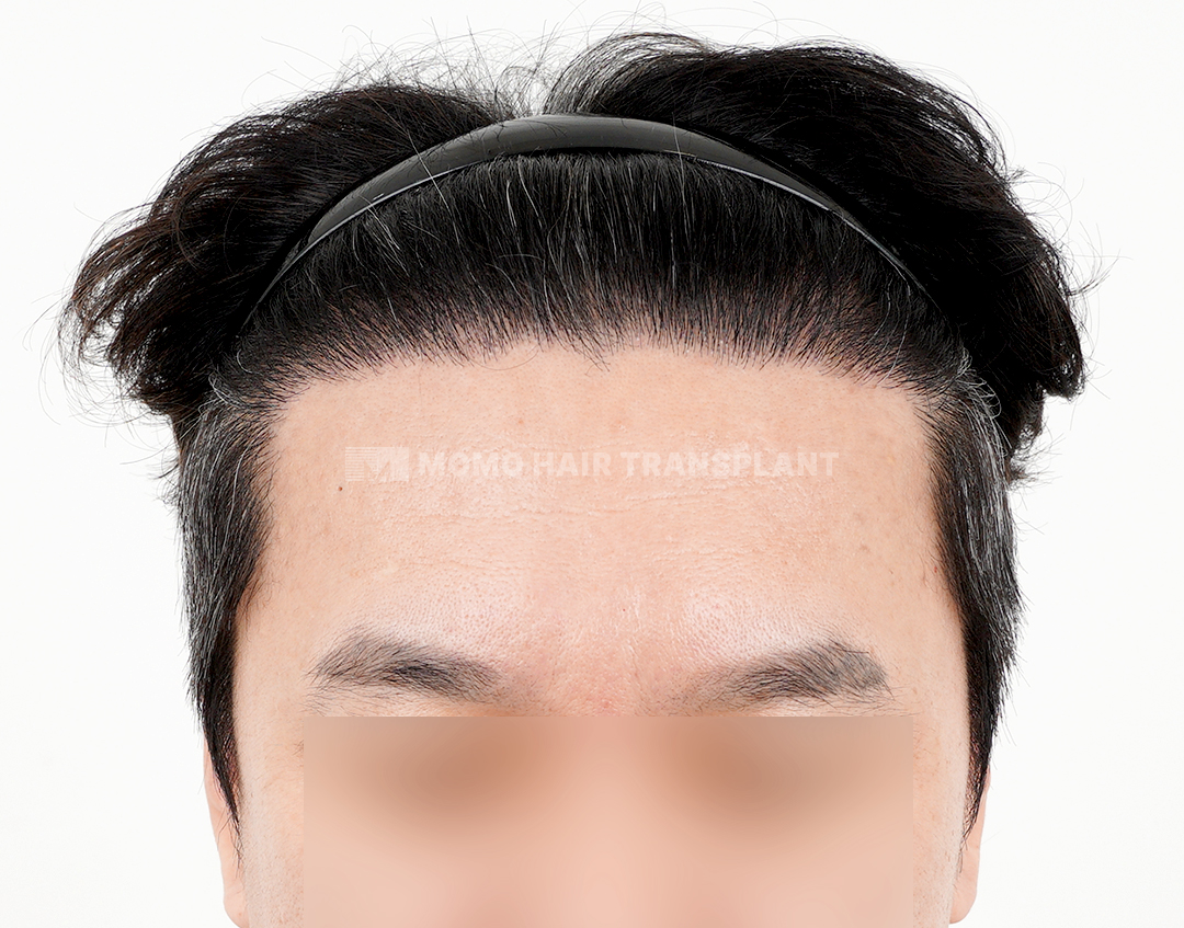 After