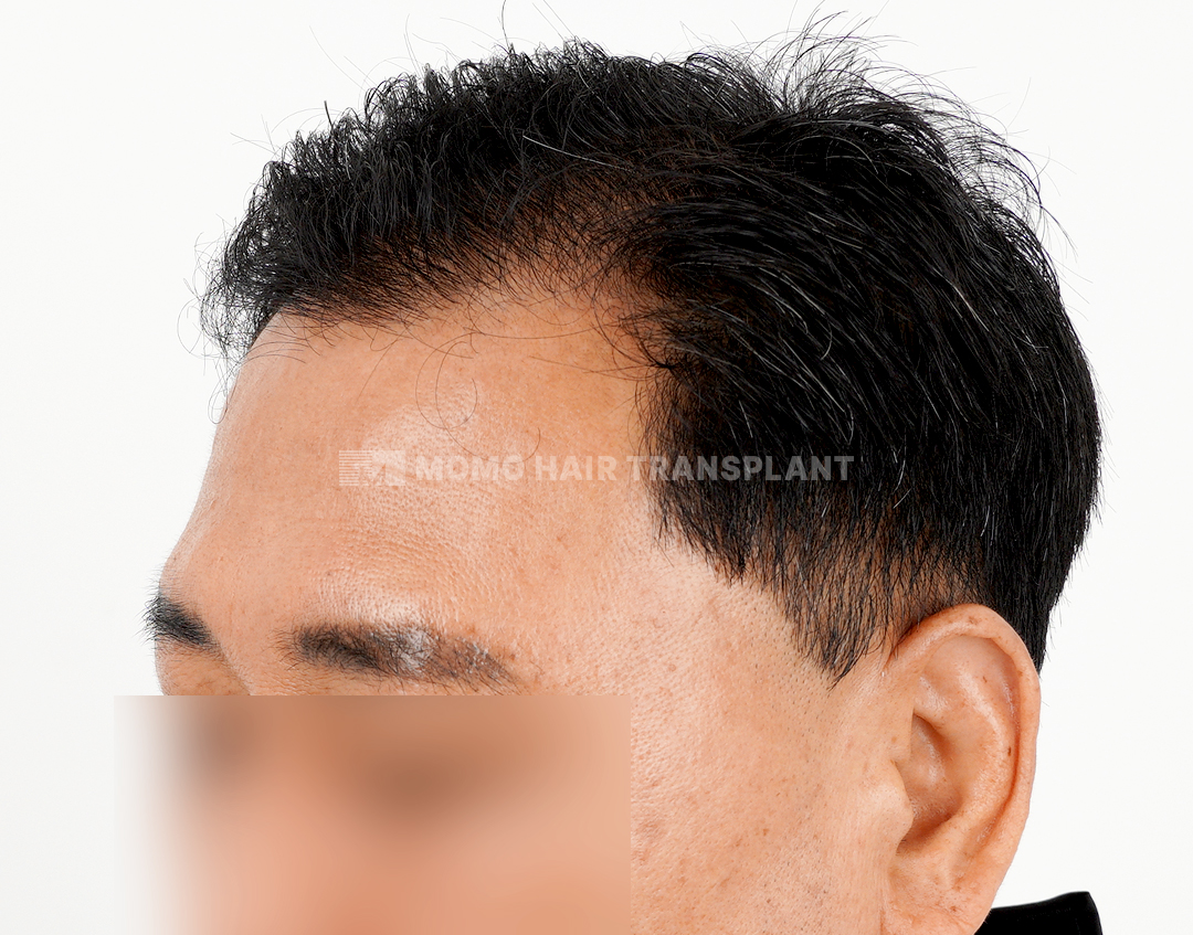 After