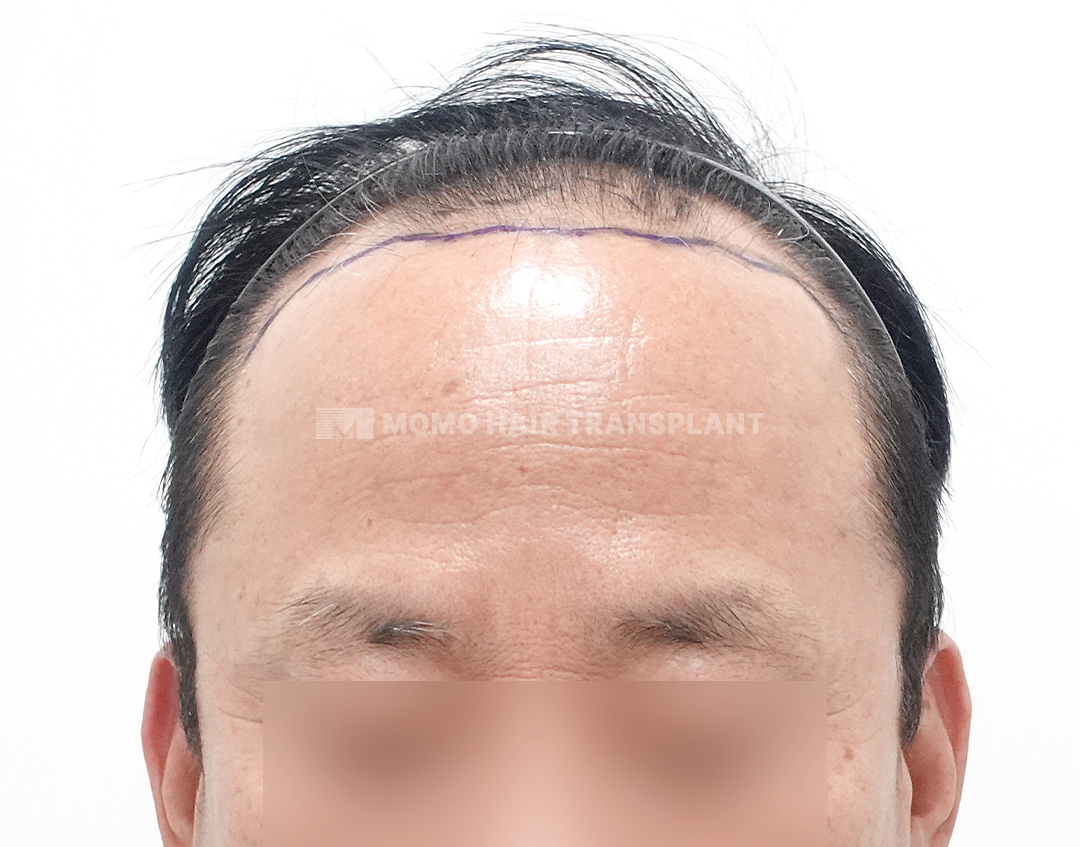 Before