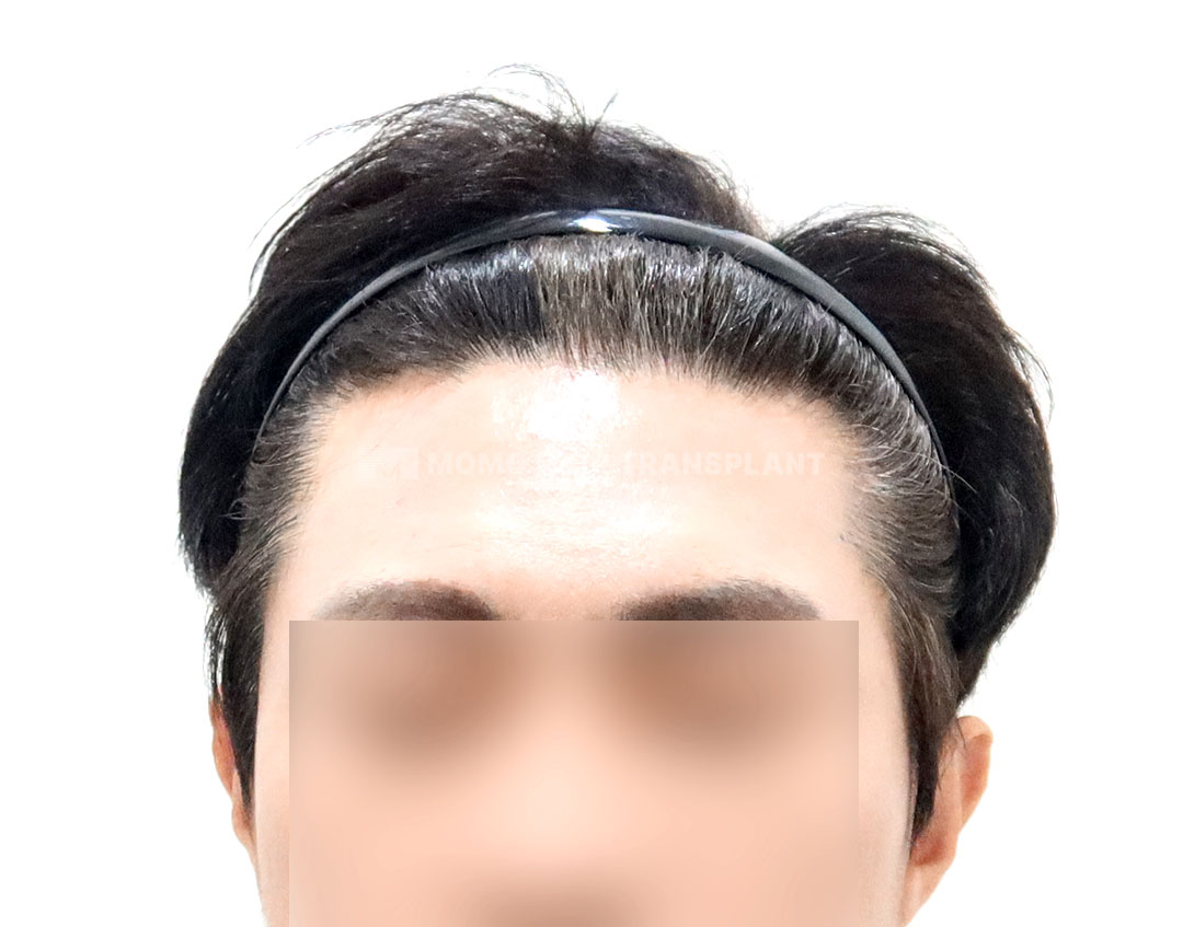 After