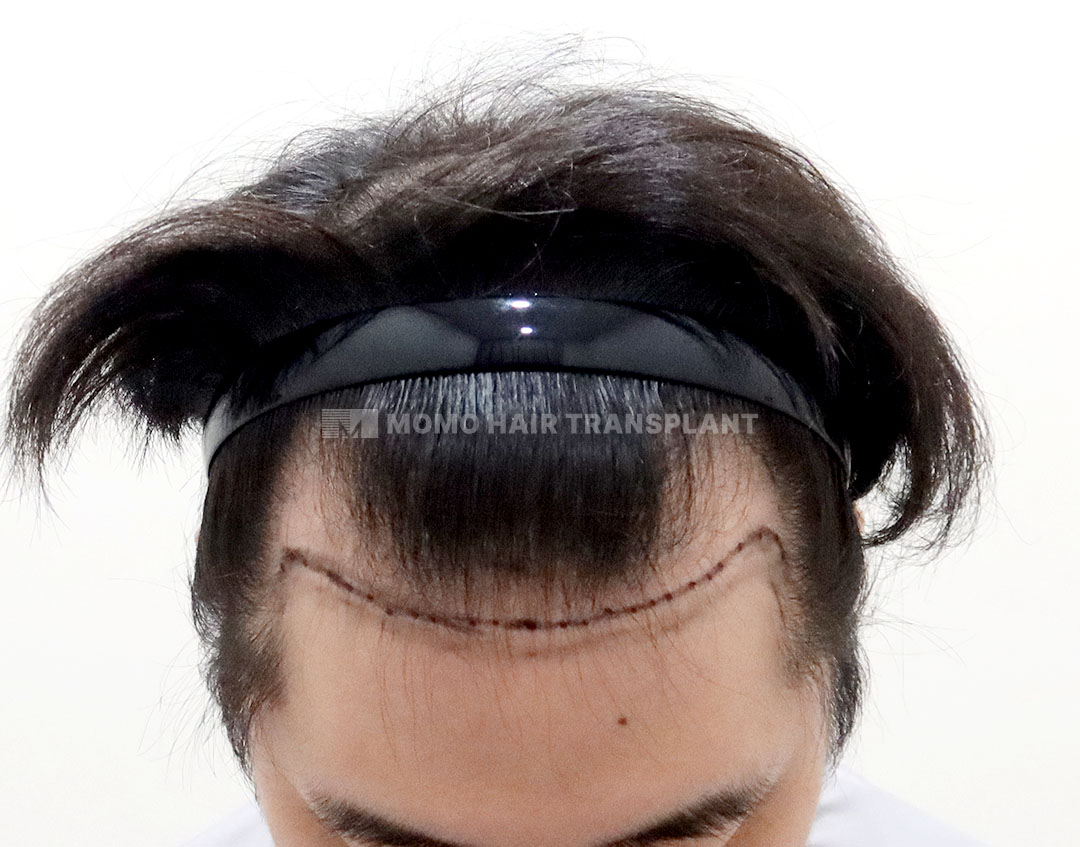 Before