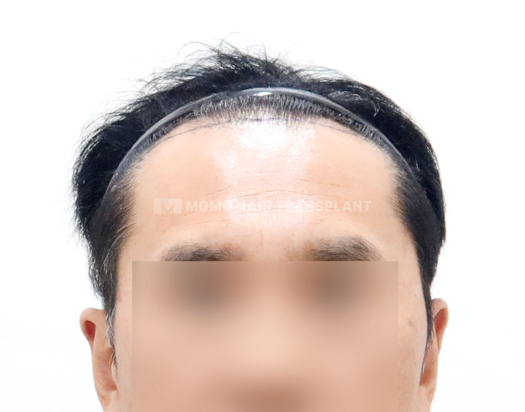 Before