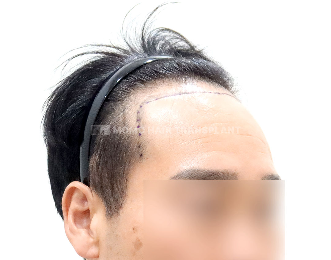 Before