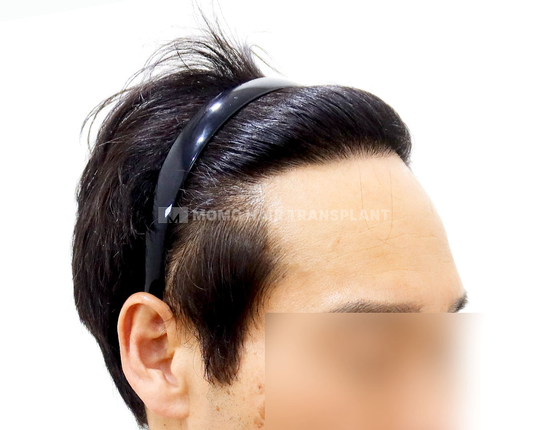After