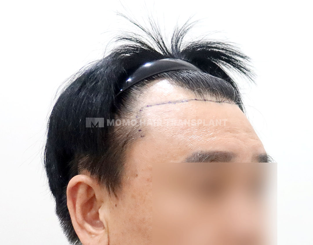 Before
