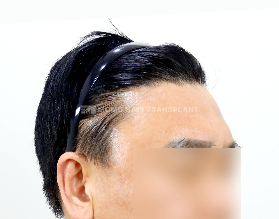 After