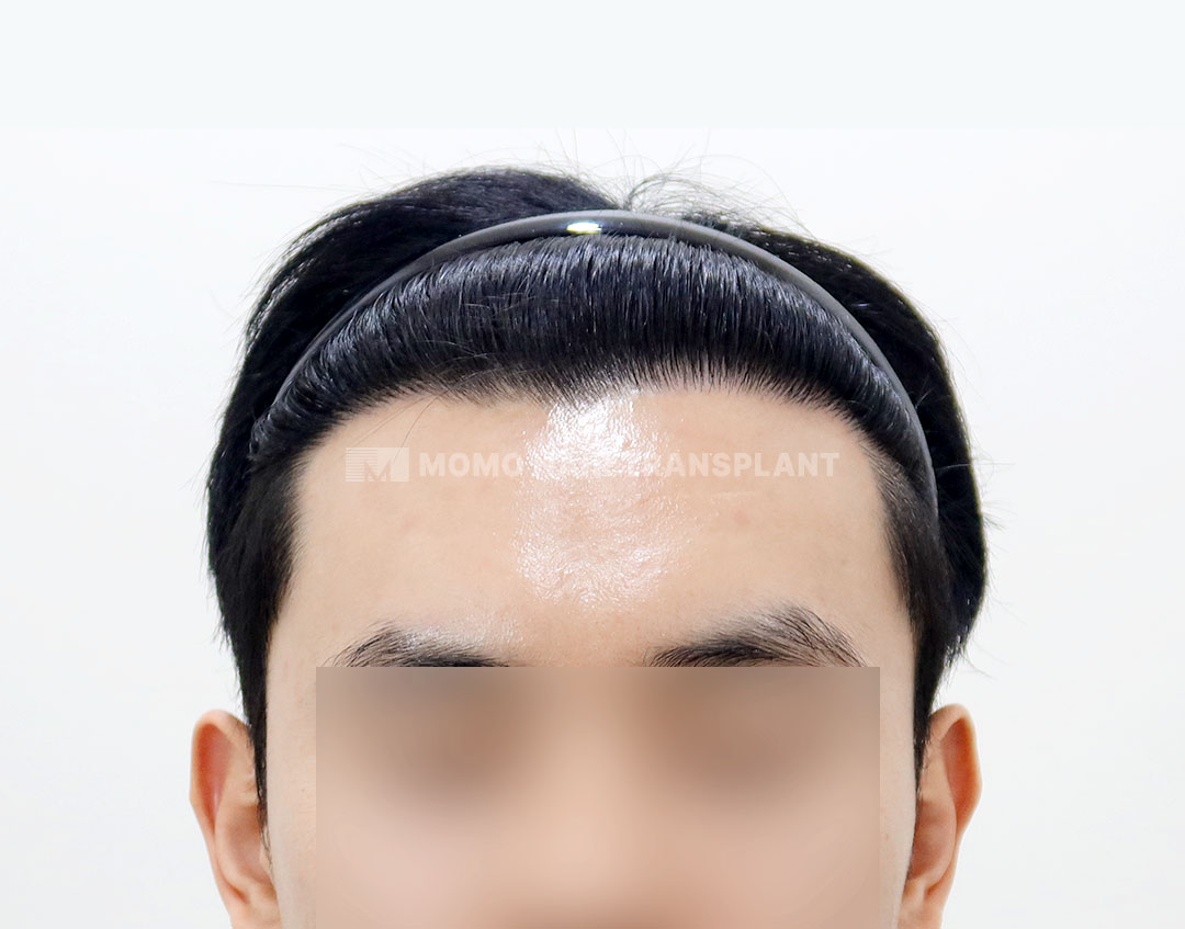 After