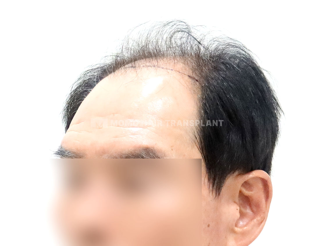 Before