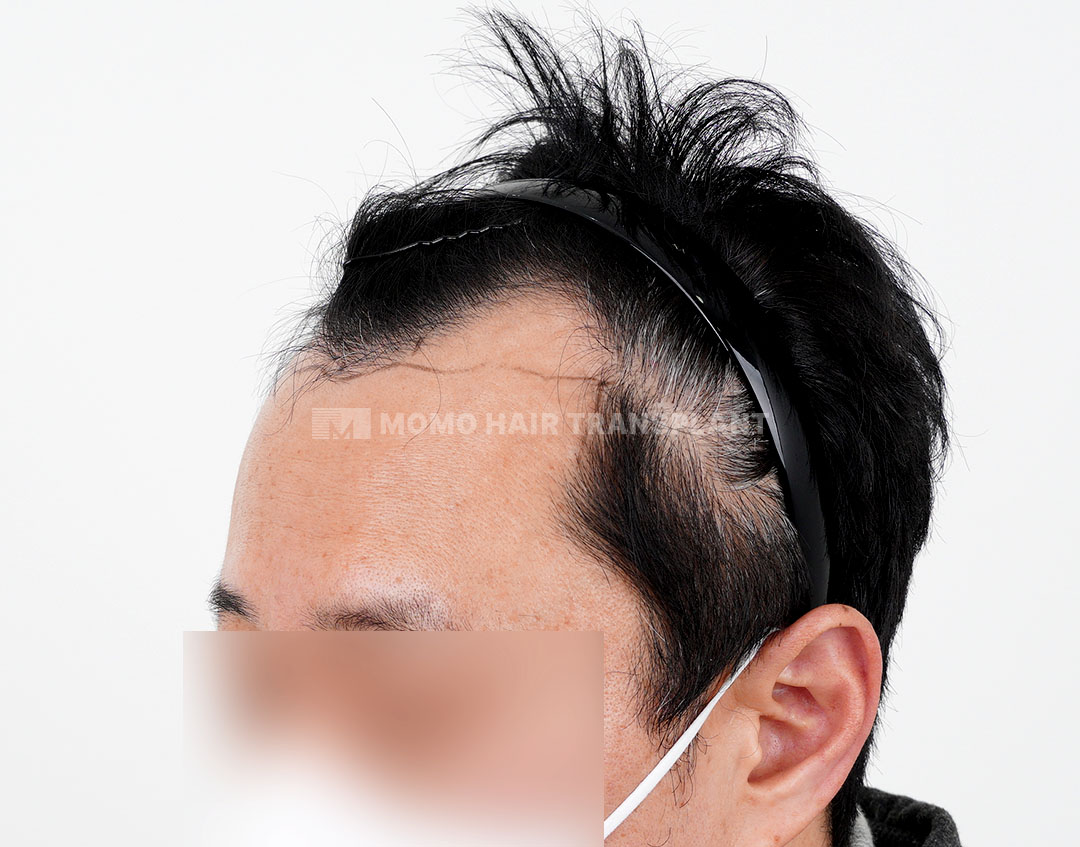 Before