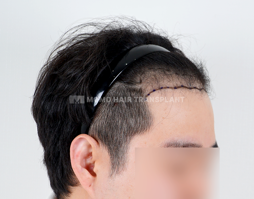 Before