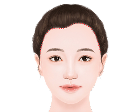非対称額