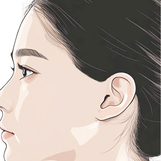 もみあげ1