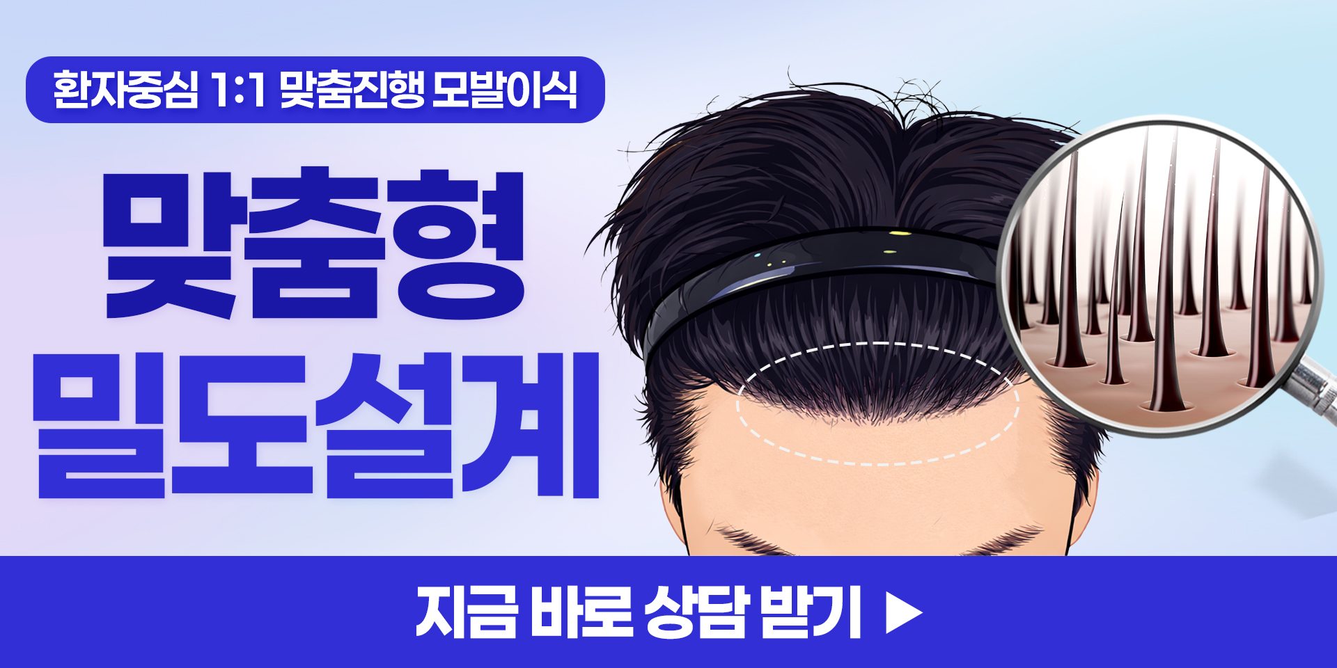 모발이식 견적 받아보기
