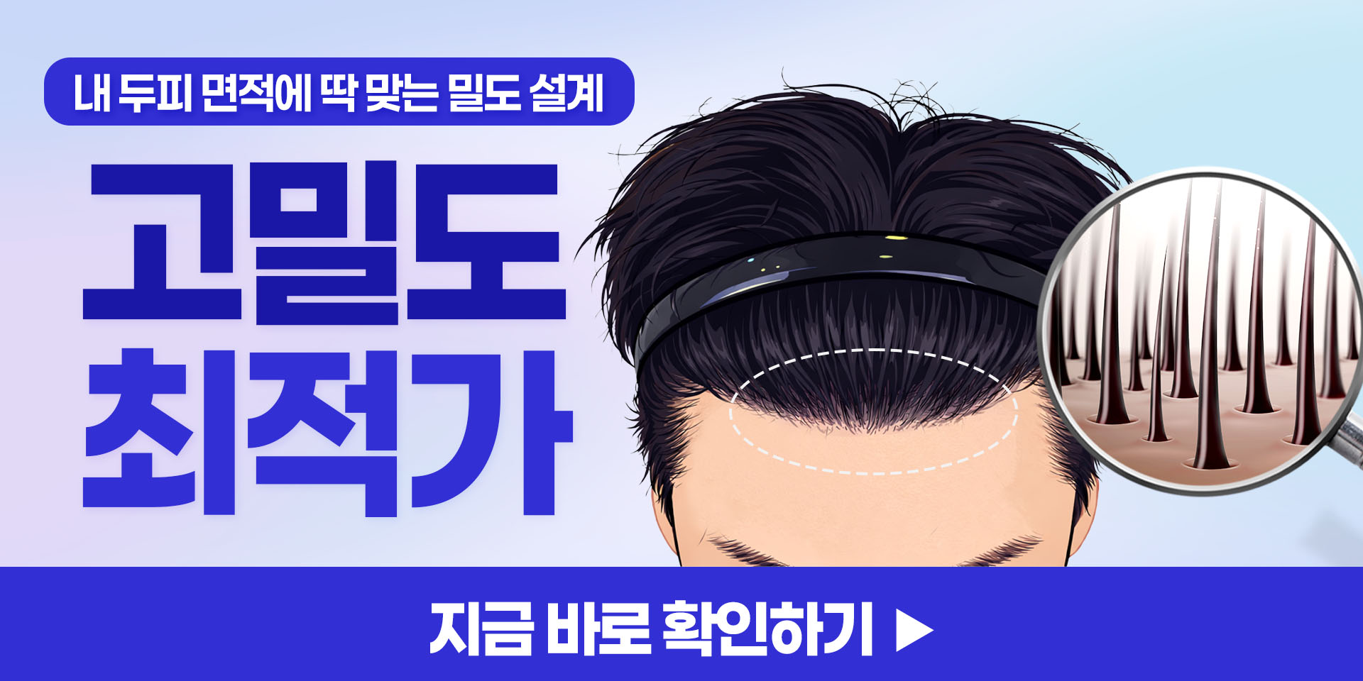 모발이식 견적 받아보기