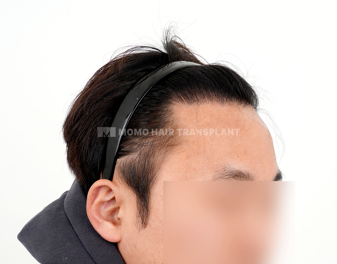 After