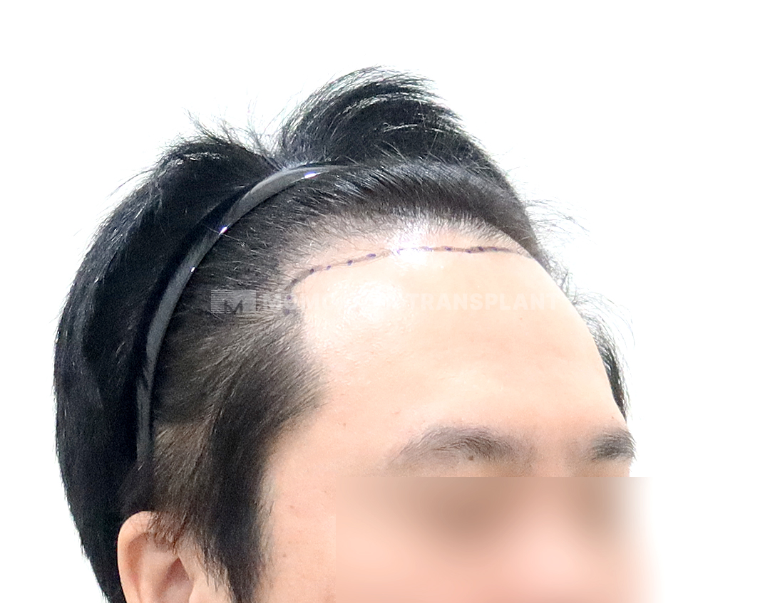 Before