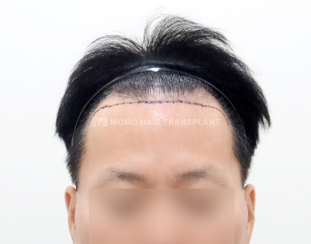 Before