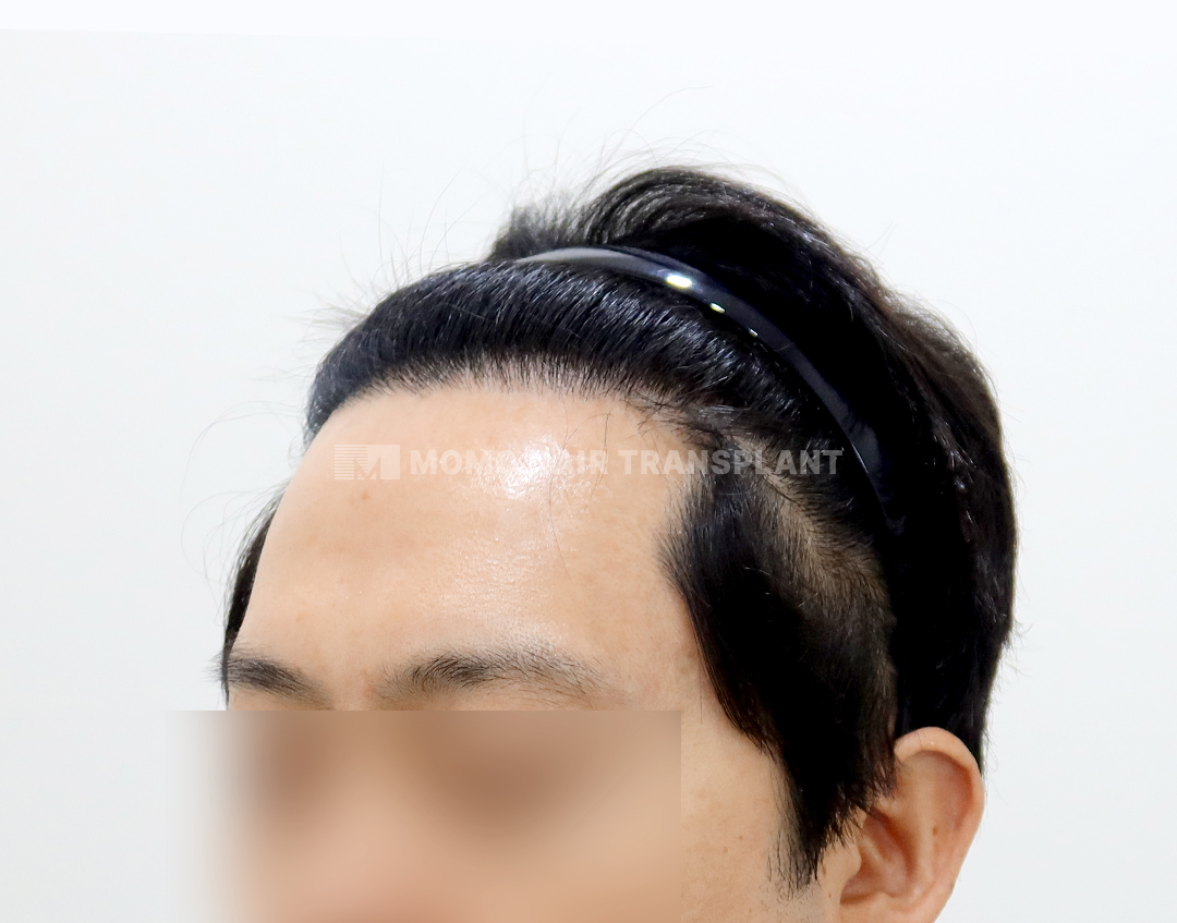 After