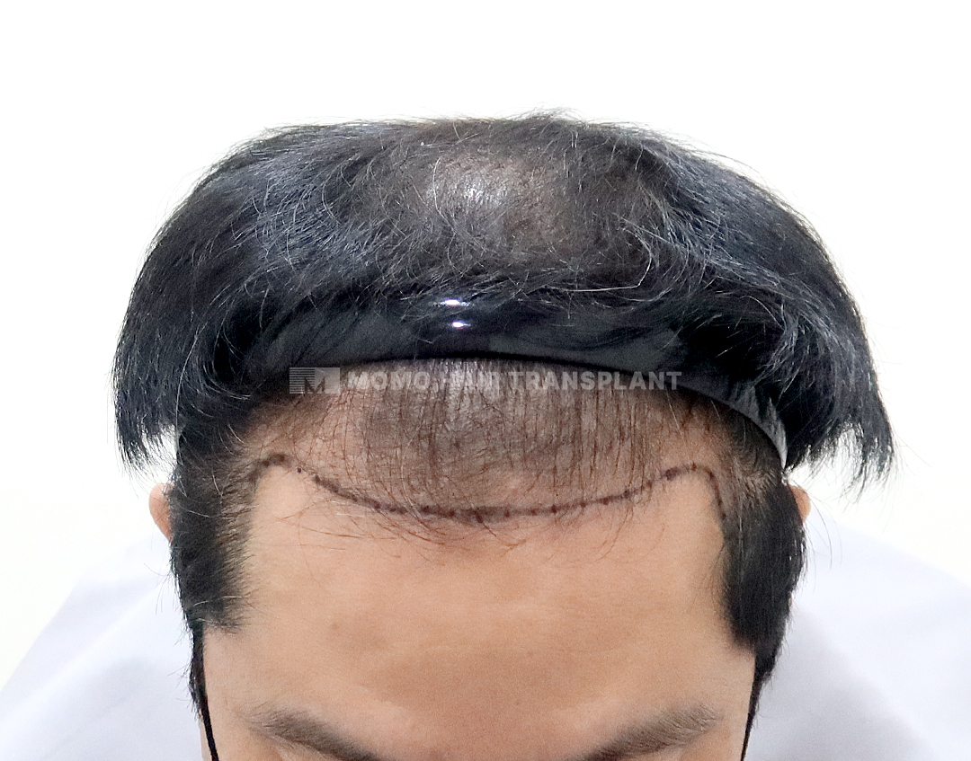 Before