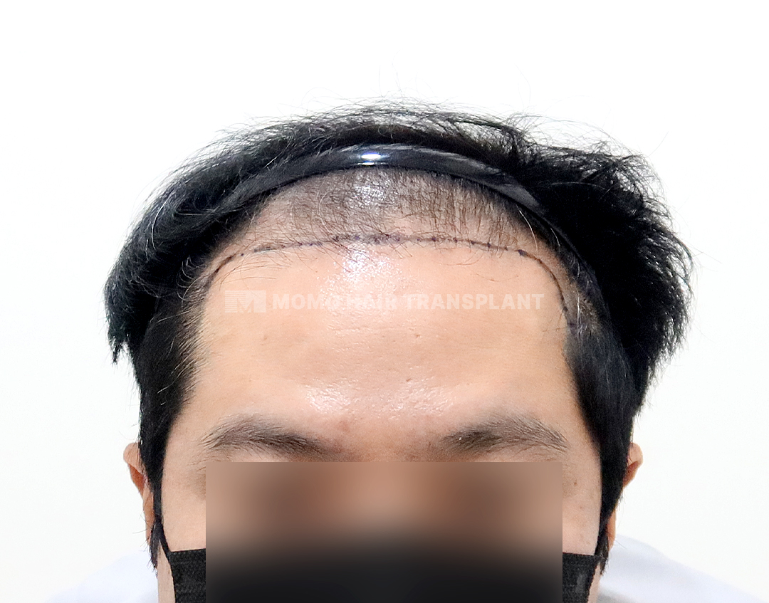 Before