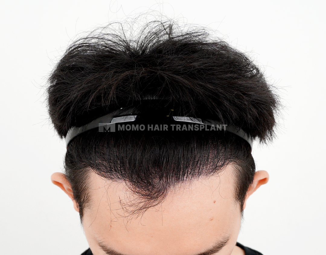 After