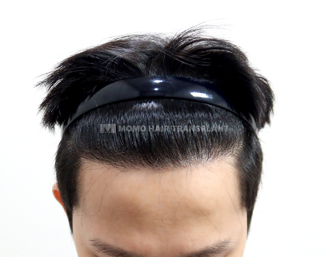 After