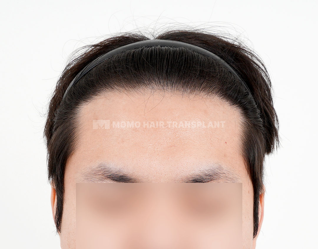 After