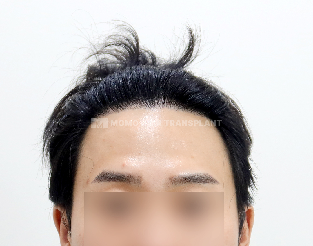 After