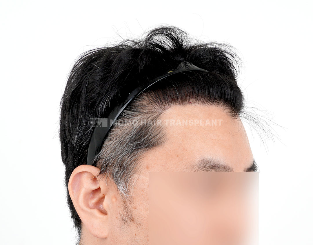 After