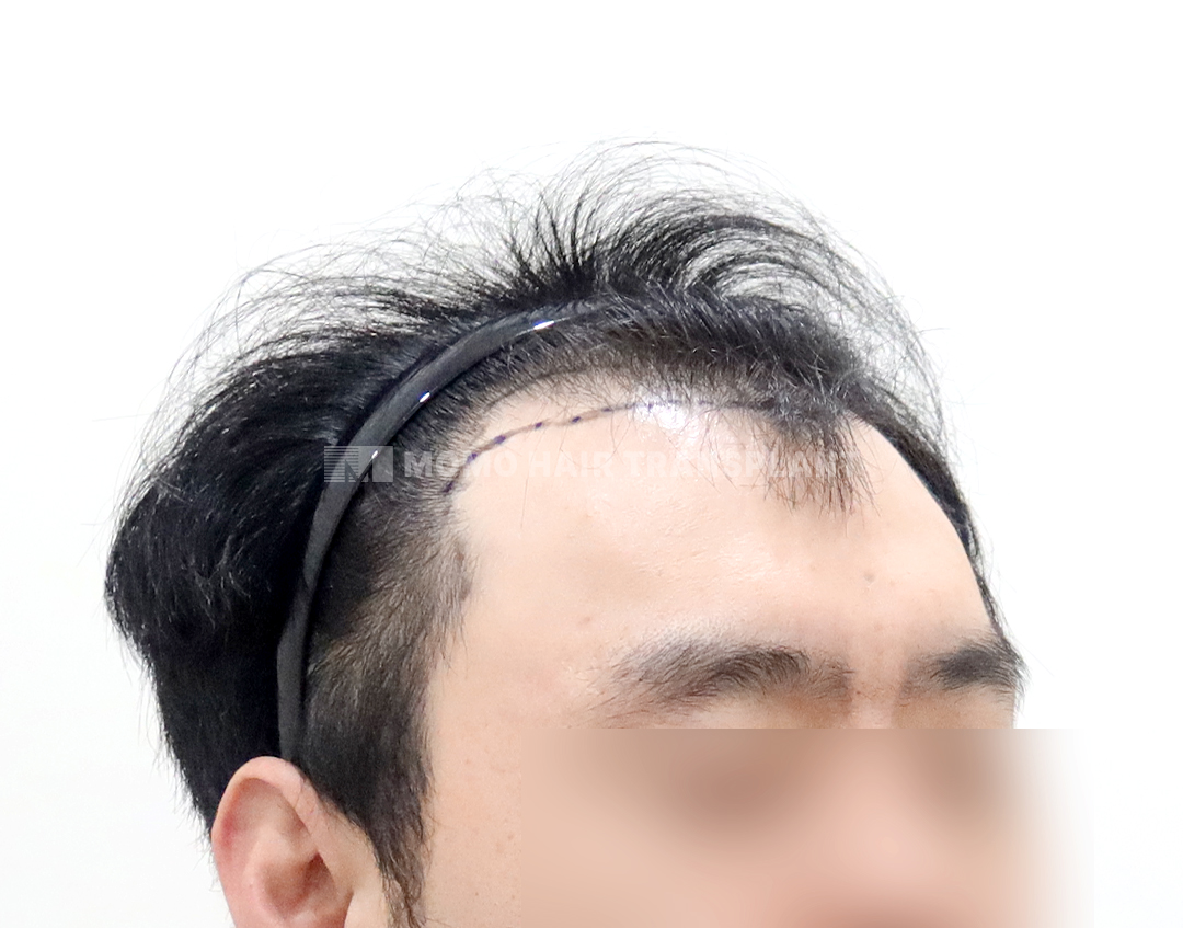 Before