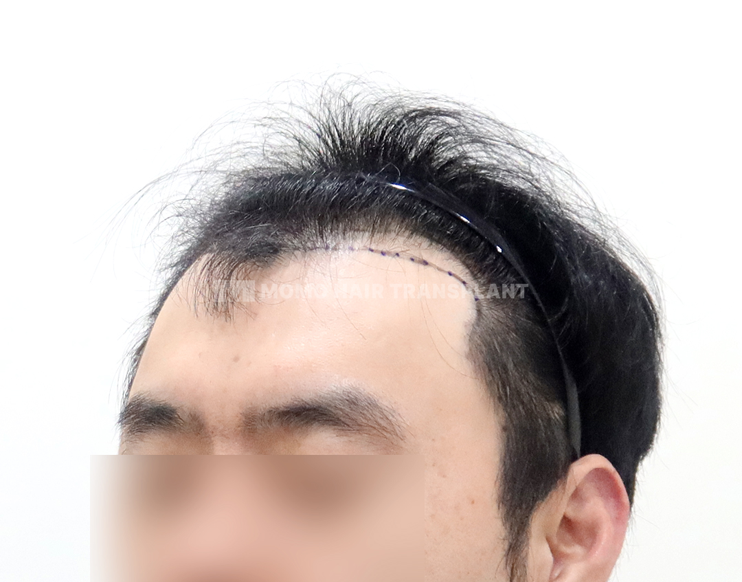 Before