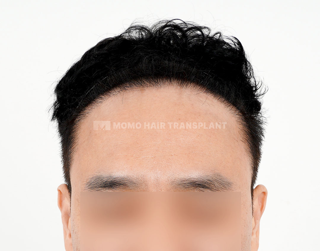 After