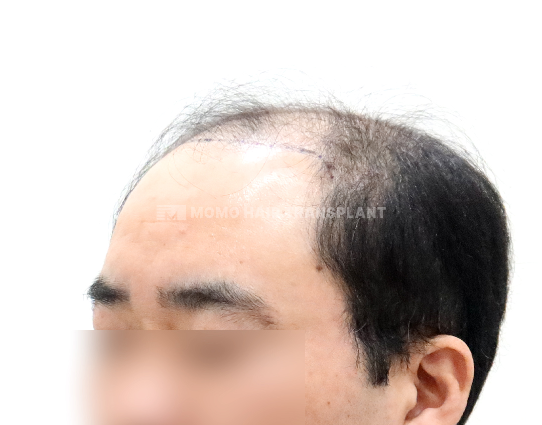 Before