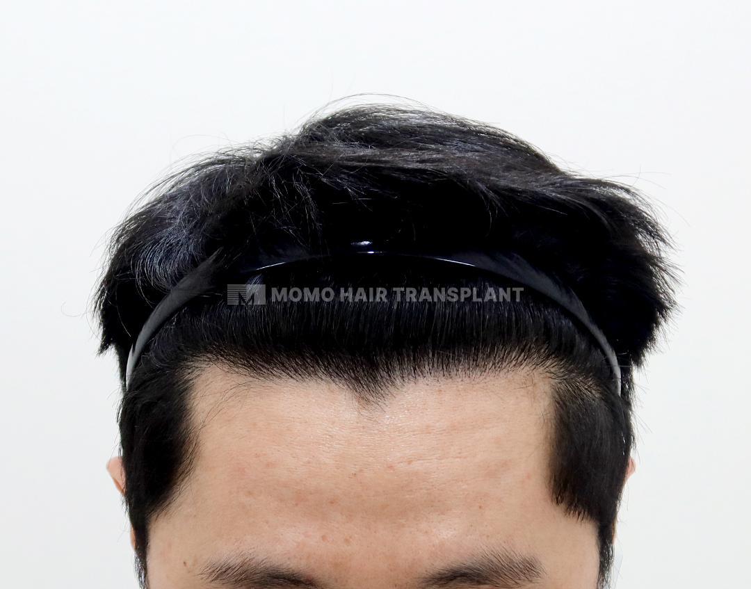 After