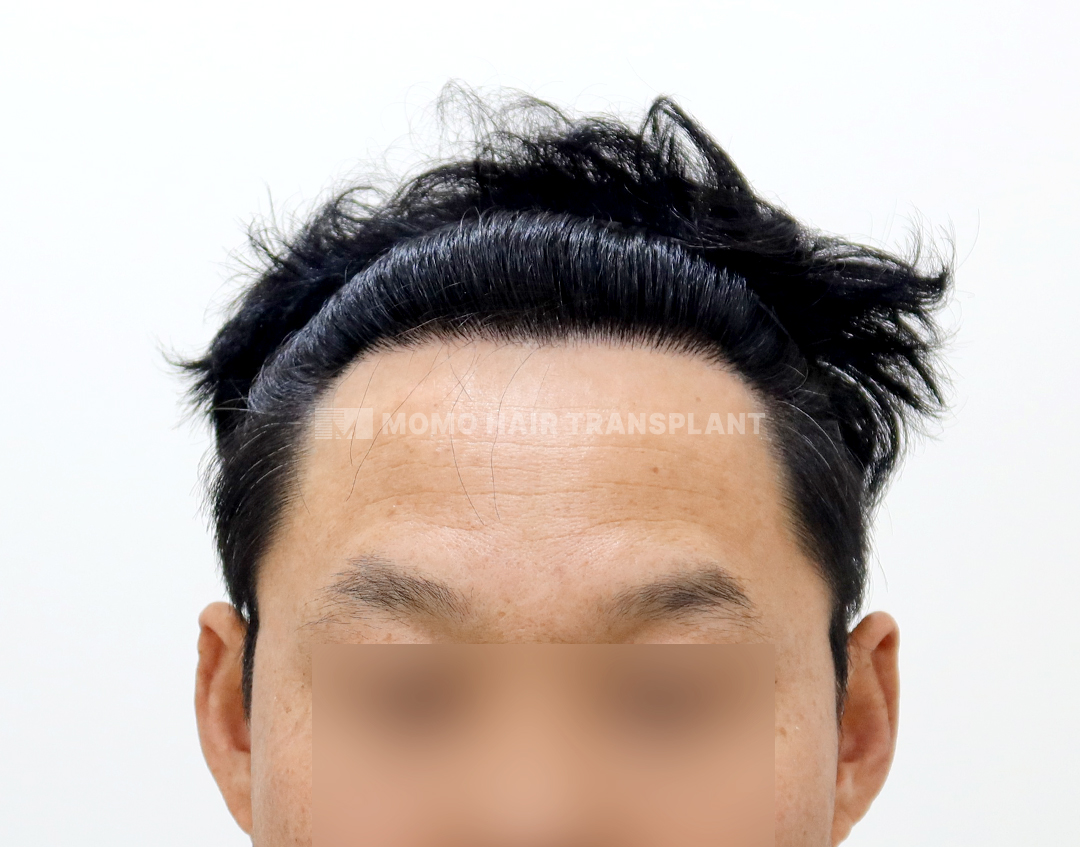 After