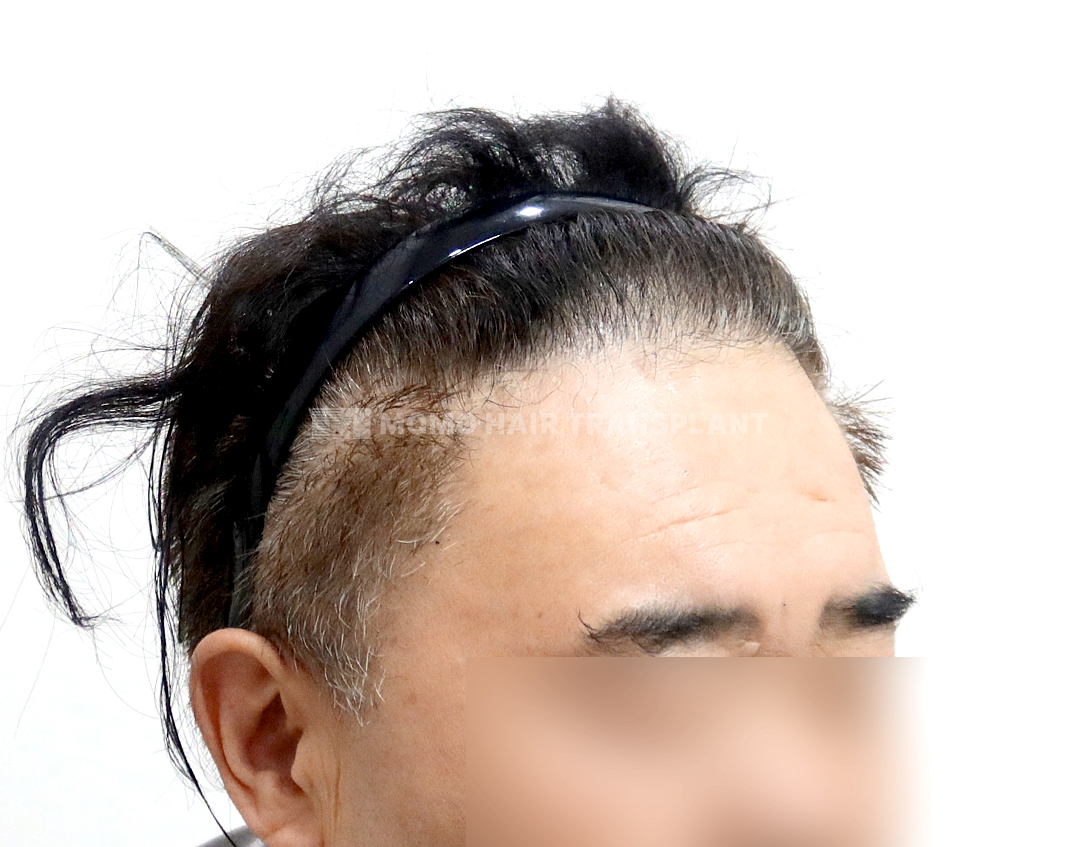 After