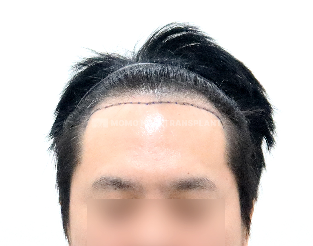 Before
