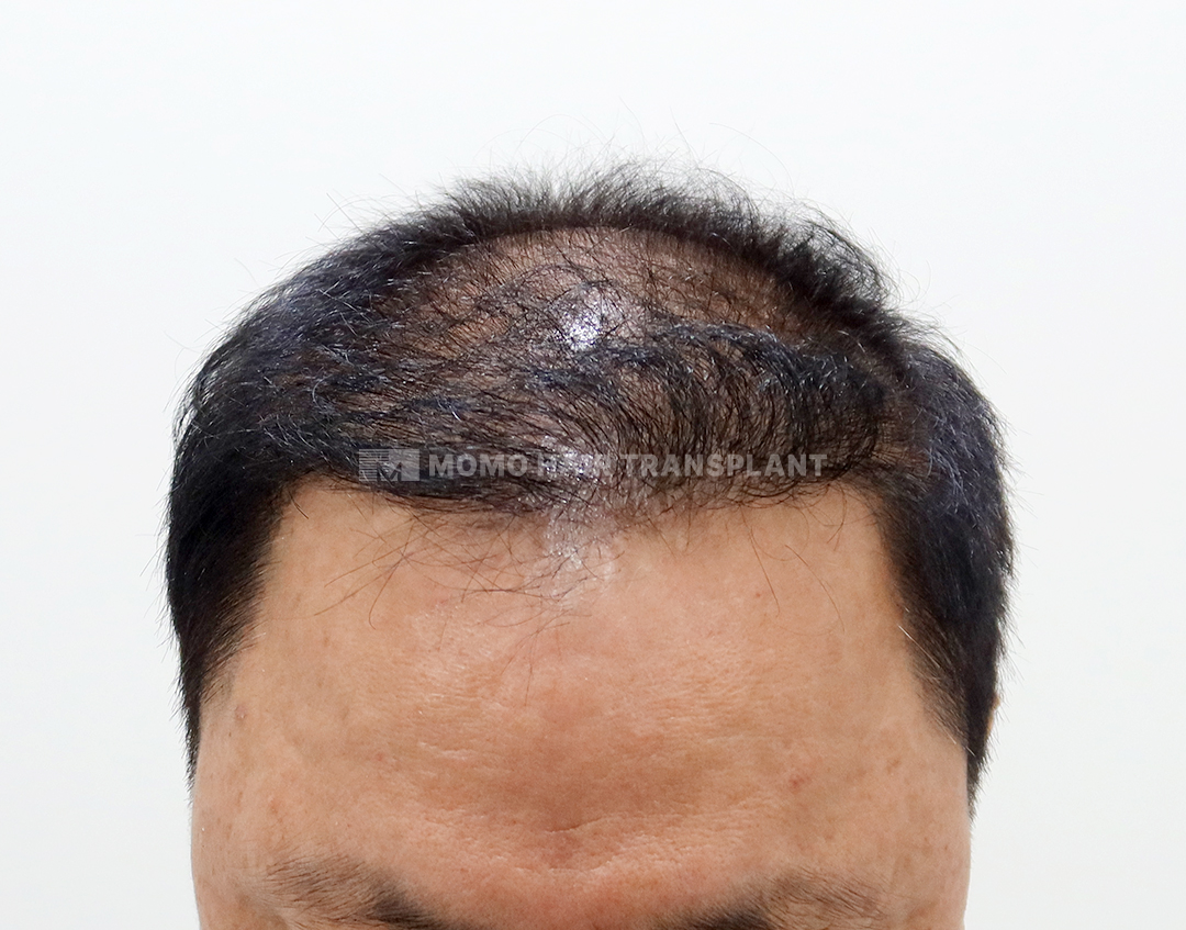 After