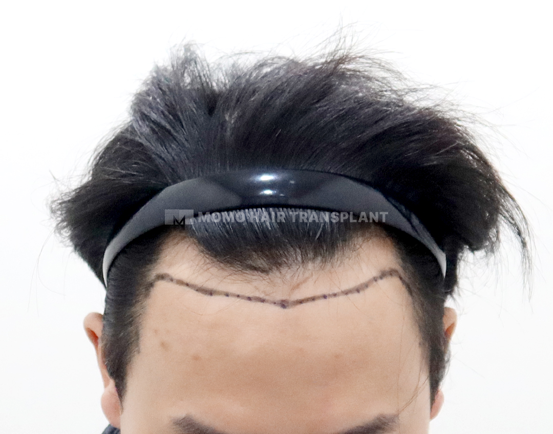 Before