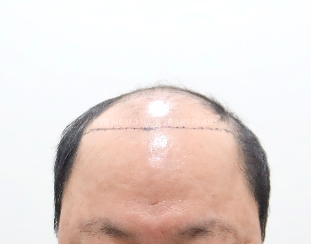 Before