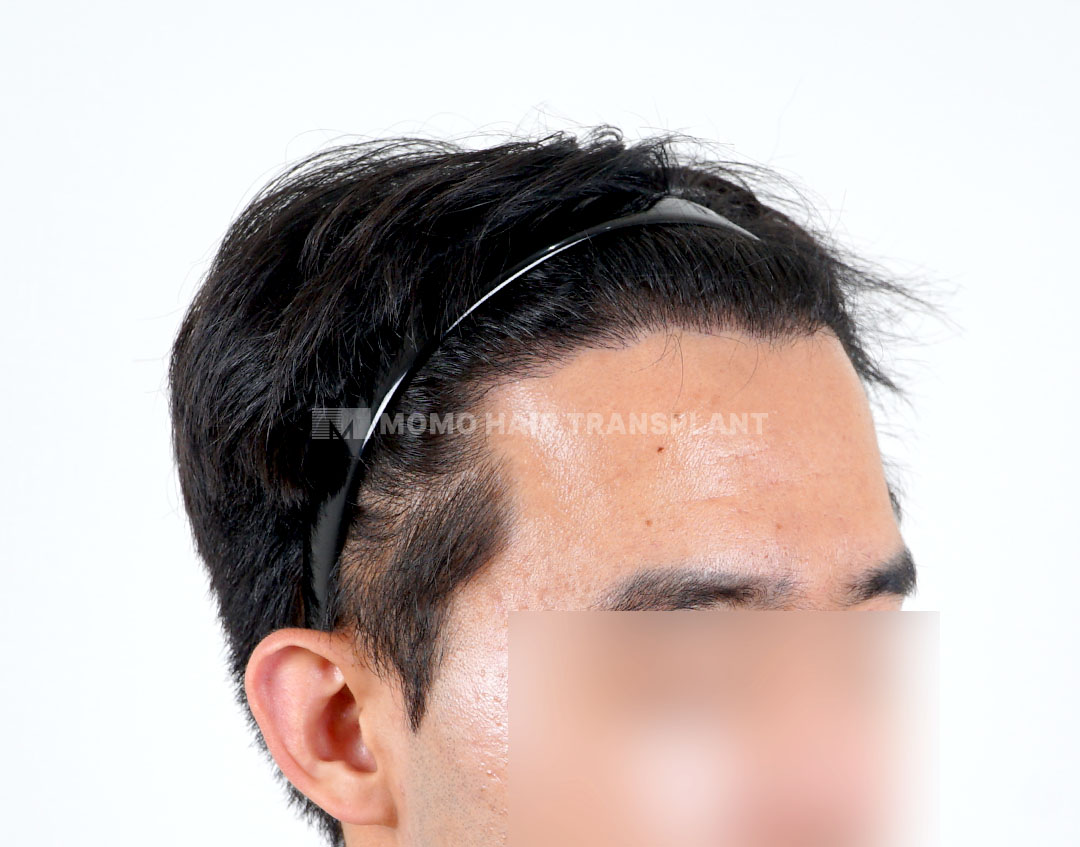 After