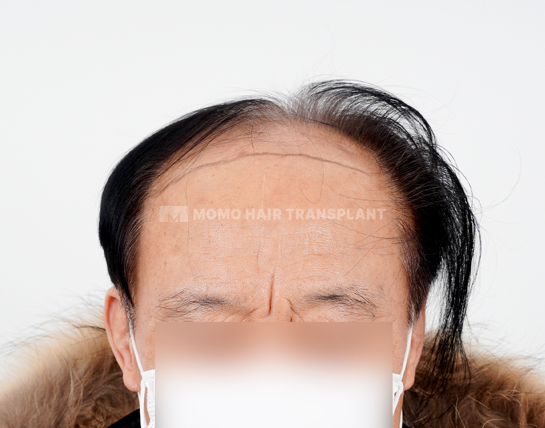 Before